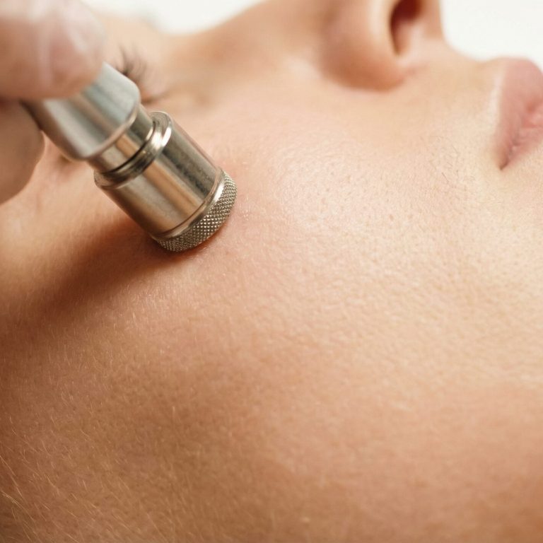 banner_mikroabrasion