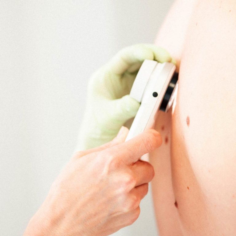 banner_muttermalkontrolle_fokus