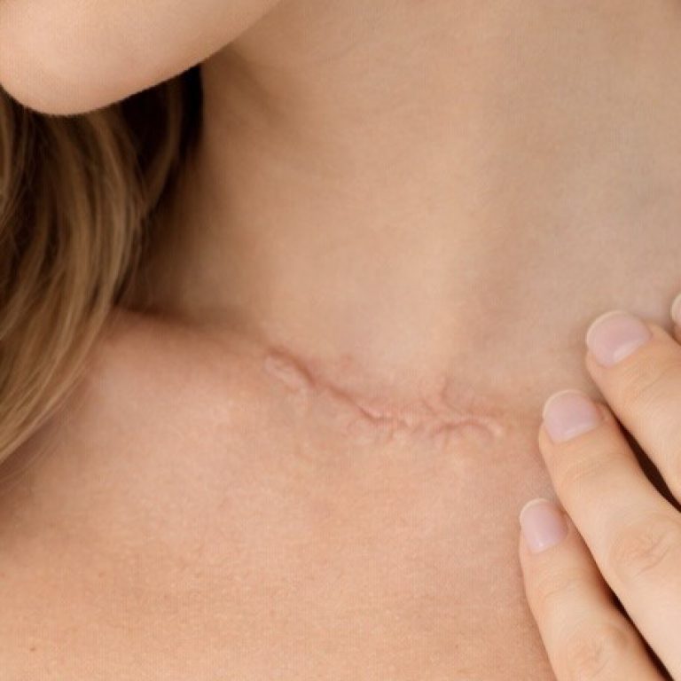 docfinder_narben_16_9